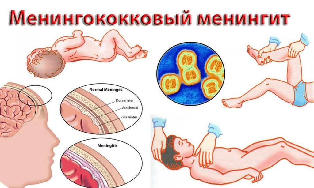 Красные точки по всему телу - Вопрос дерматологу - 03 Онлайн